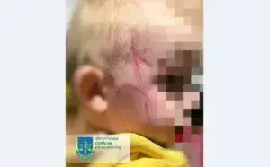 Постраждала дитина