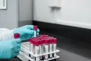 Аналіз на рівень холестерину