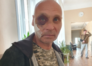 У Запоріжжі жорстоко побили військового