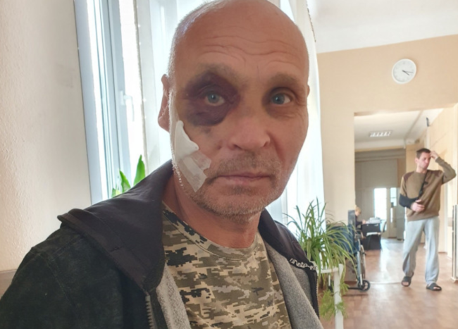 У Запоріжжі жорстоко побили військового