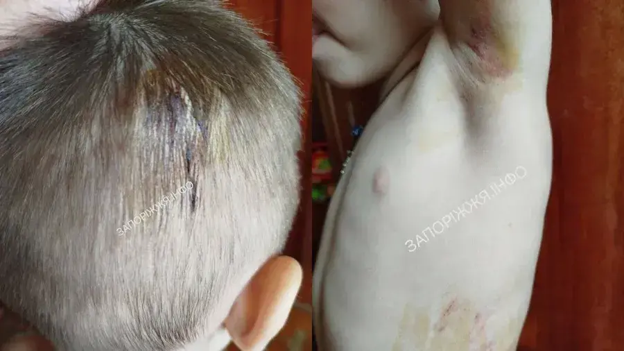 У Запоріжжі 3-річний малюк провалився в люк